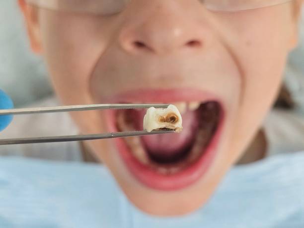 Best Emergency Pediatric Dentist  in King City, OR